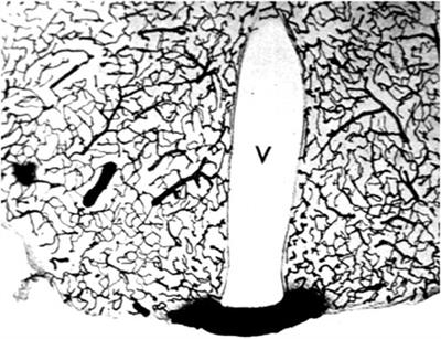 Receptor-mediated drug delivery of bispecific therapeutic antibodies through the blood-brain barrier